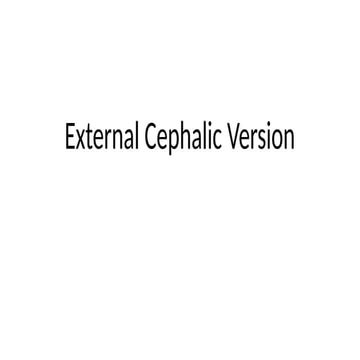 External  Cephalic  Version ( ECV ).pptx