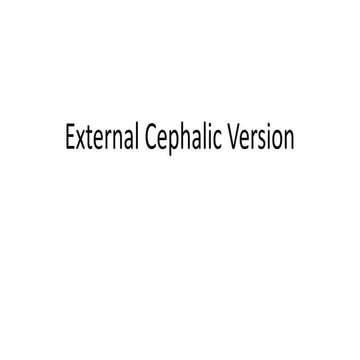 External  Cephalic  Version. ( ECV ).pptx