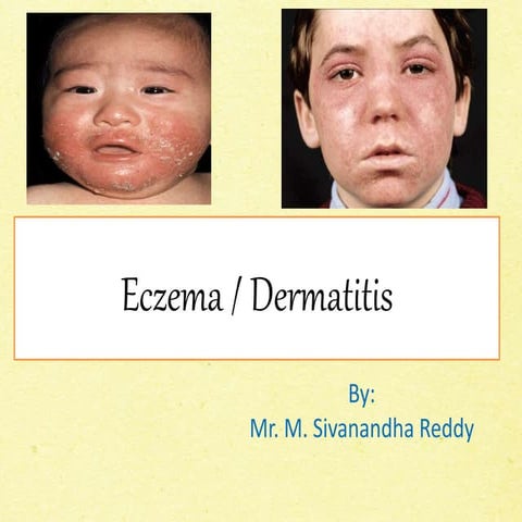 Eczema