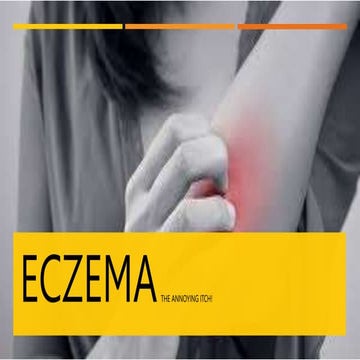 ECZEMA.                                 .