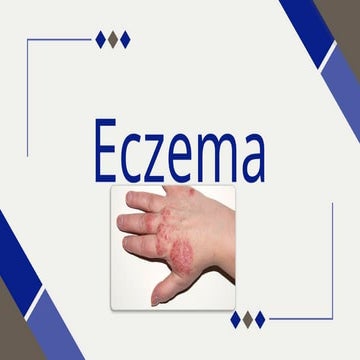 Overview about Eczema and Treatment.pptx