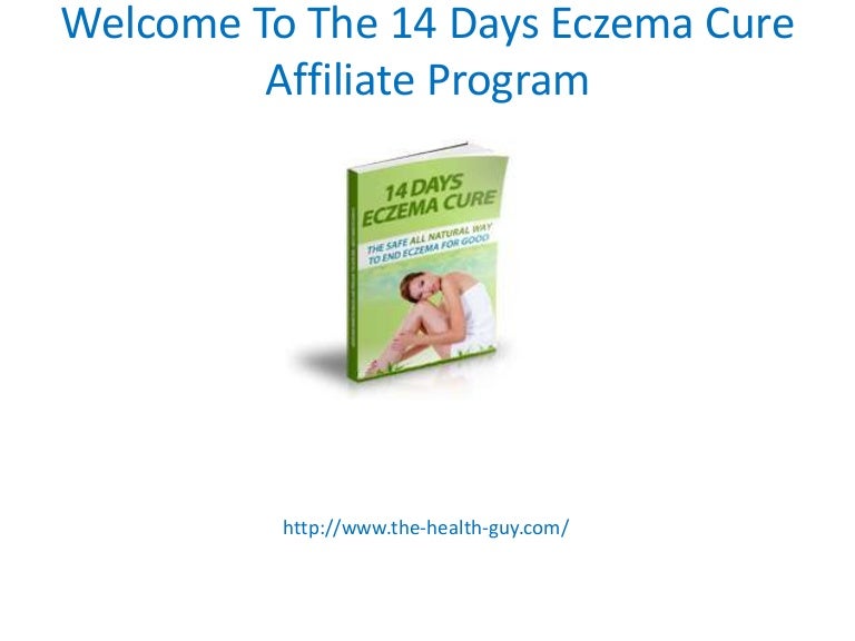 Eczema Treatment Over The Counter