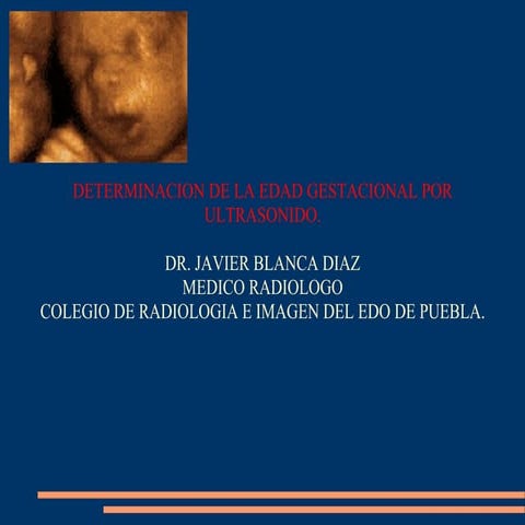 Edad gestacional-por-us