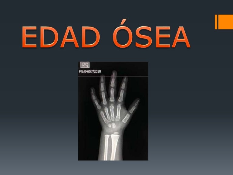 Edad ósea