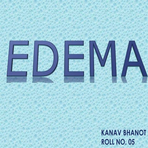 Edema