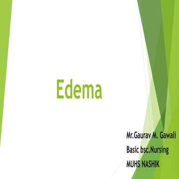 edema.pptx
