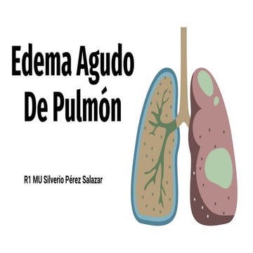 edemaagudodepulmn-230313054327-a006454c.pptx