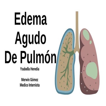 Edema agudo de pulmón basico. pptx_20240627_123316_0000.pptx