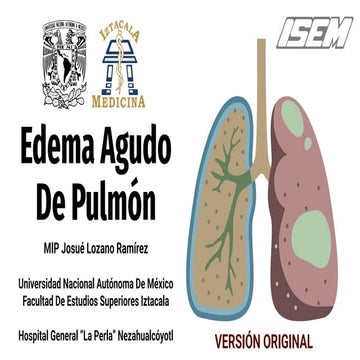 Edema Agudo De Pulmón (versión original)