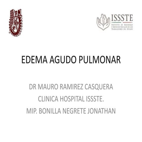 Edema agudo pulmonar