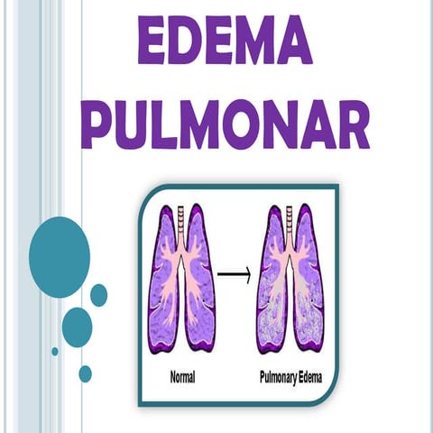 Edema pulmonar