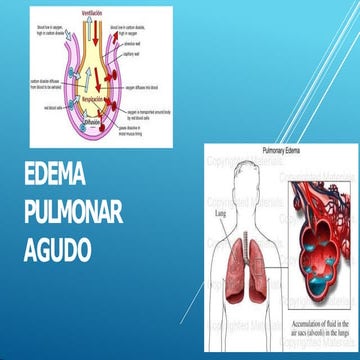 edema pulmonar agudo presentacionnnn.pptx