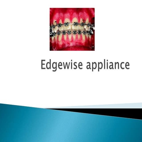 Edgewise appliance