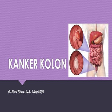 Comprehensive Overview of Colon Cancer: Risks, Diagnosis, and ...