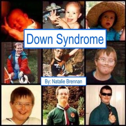 Down Syndrome