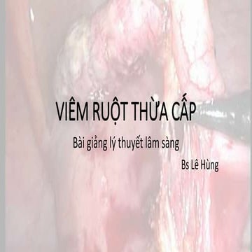 Viêm ruột thừa cấp