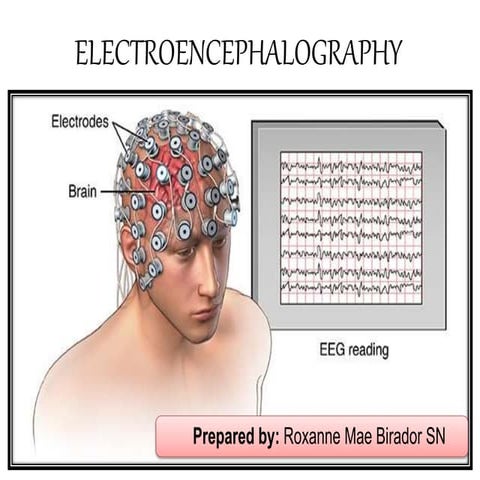 ELECTROENCEPHALOGRAM/ ELECTROENCEPHALOGRAPHY