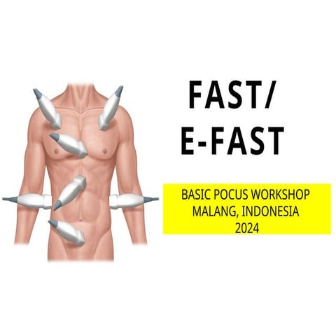 EFast. EFast. EFast. EFast. E.fast. EFAST.pptx