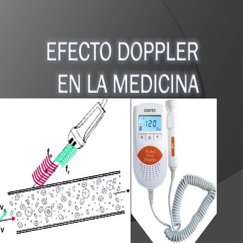 Efecto doppler en la medicina