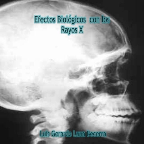 Efectos Biológicos de Rayos X