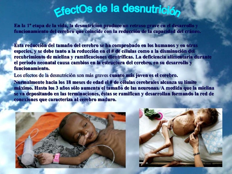 Efectos de la desnutricion