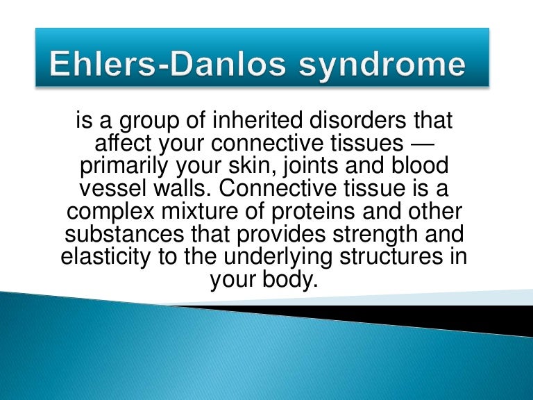Ehlers danlos syndrome