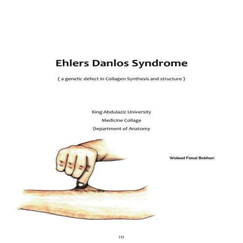 Ehlers Danlos Syndrome | PDF