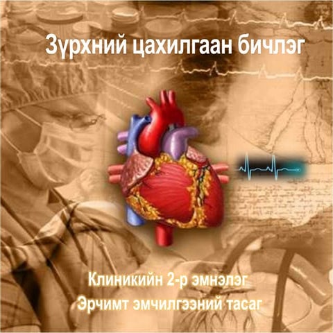 Ekg