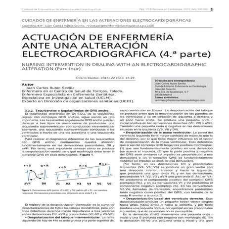 Actuación de enfermería ante una alteración electrocardiográfica (4º parte)