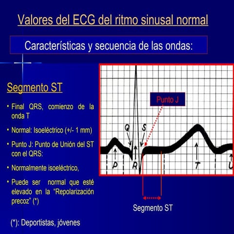 Ekg en la cardiop isquemica