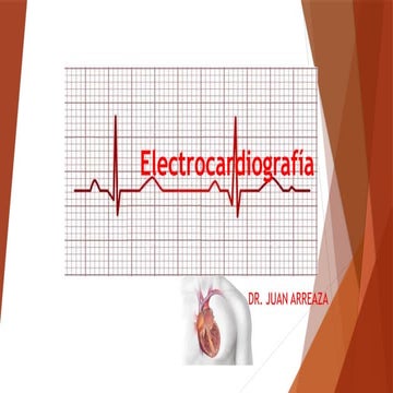 Electrocardiograma 24927-16517-3883.pptx