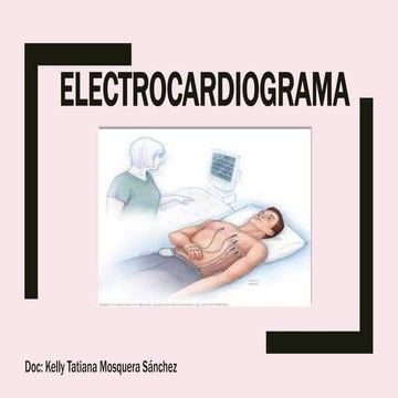 EKG KELLY TATIANA MOSQUERA.pptx