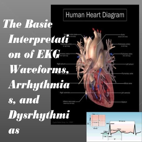Ekg presentation