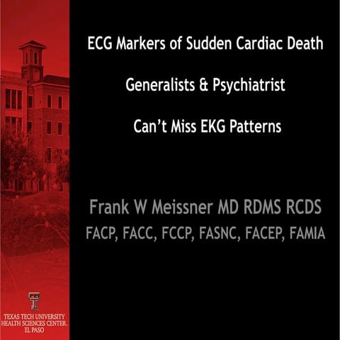 EKG Patterns of SCD - Can't Miss EKG Patterns for Generalist & Psychiatrist