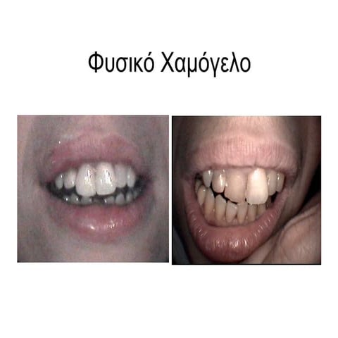 ΣΟΦΙΑ ΛΟΥΚΕΡΗ #2