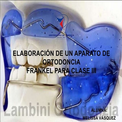 ELABORACIÓN DE APARATO FRANKEL III | PPSX