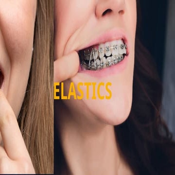 Elastics in orthodontics | PDF