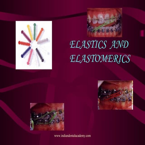 Elastics & elastomerics /certified fixed orthodontic courses by Indian dental...