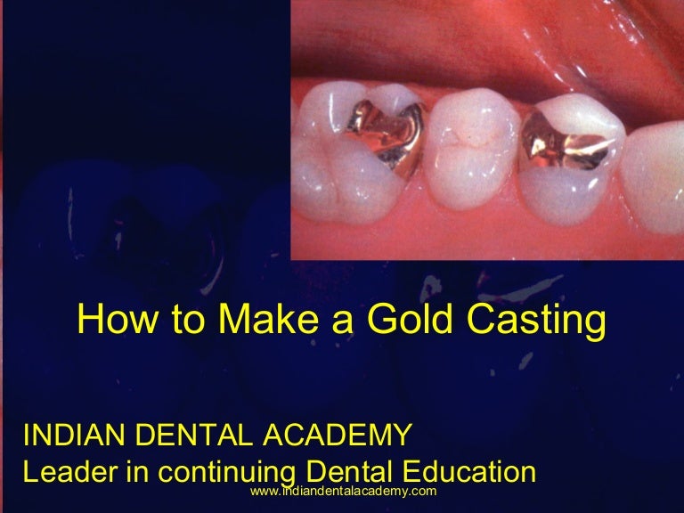 Elastomers /orthodontic courses by Indian dental academy