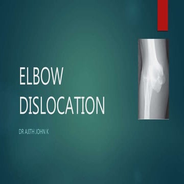 Elbow dislocations