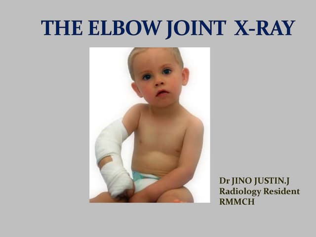 Anatomy of elbow joint | PPTX