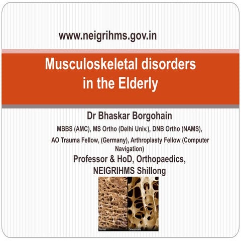 Common Musculoskeletal (orthopedic) disorders in elderly