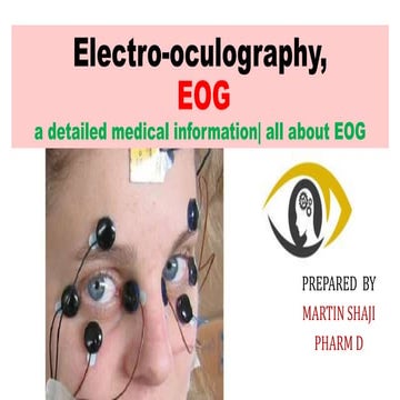 Electro oculography, EOG -a detailed medical information| all about EOG 
