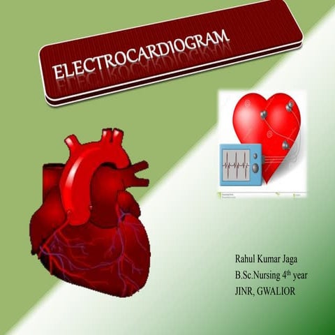 Electrocardiogram (ECG) / ECG interpretation