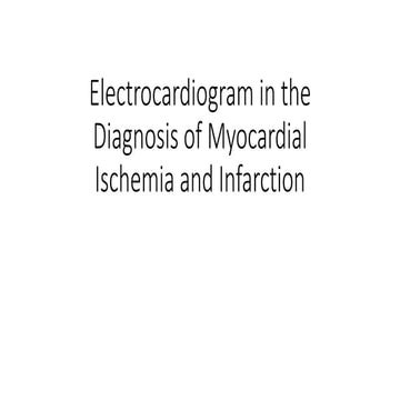 Electrocardiogram in myocardial infarction 