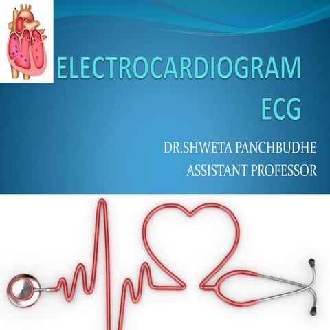 Electrocardiogram