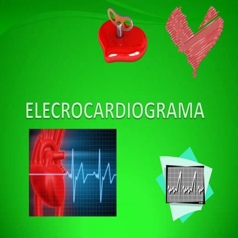Electrocardiograma