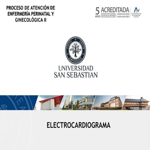 ElectrocardiogramadcncsjnvcjKMmvjvjj.pdf