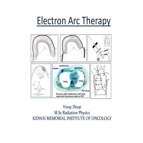 Electron arc therapy