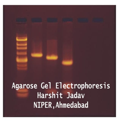 Agarose Gel Electrophoresis